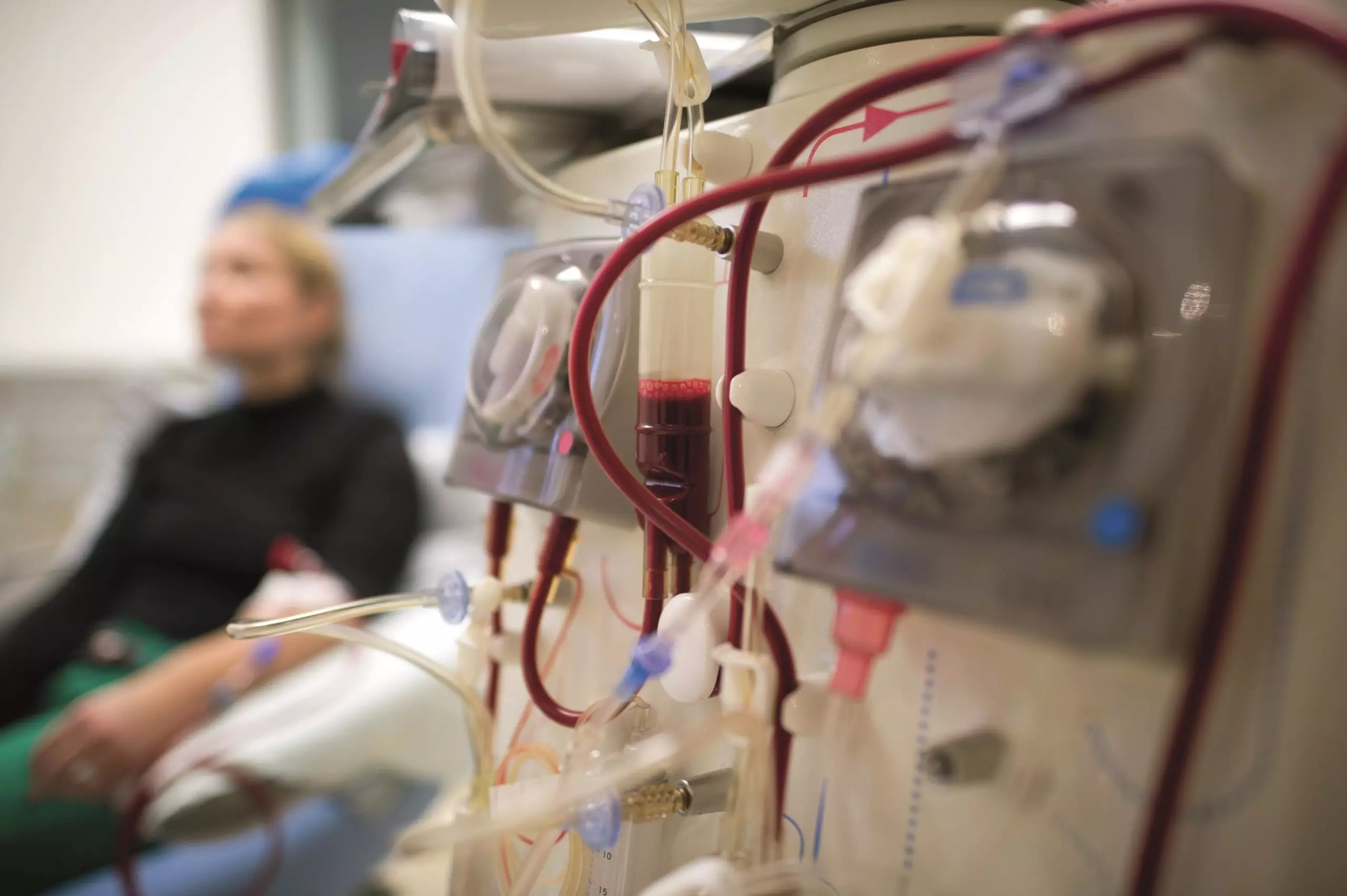 PhilHealth Expands Z Benefit Package for Peritoneal Dialysis